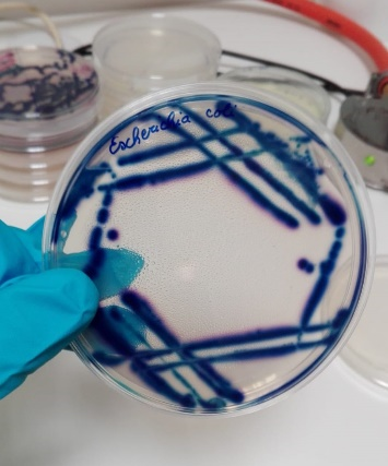 Charakterizácia baktérií v Petriho miskách
